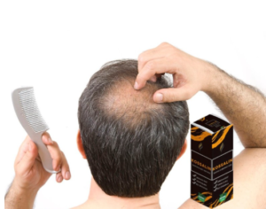 Učinki uporabe Kossalin Šampon, izkušnje
